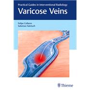 Varicose Veins,9781626230125 Varicose Veins,9781626230125