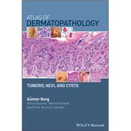 Atlas of Dermatopathology Tumors, Nevi, and Cysts,9781119371540 Atlas of Dermatopathology Tumors, Nevi, and Cysts,9781119371540