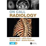 On Call Radiology,9780429161797 On Call Radiology,9780429161797