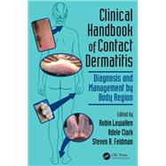 Clinical Handbook of Contact Dermatitis,9780429162930 Clinical Handbook of Contact Dermatitis,9780429162930