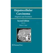 Hepatocellular Cancer: Diagnosis and Treatment,9781603273732 Hepatocellular Cancer: Diagnosis and Treatment,9781603273732
