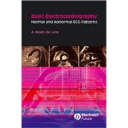Basic Electrocardiography Normal and Abnormal ECG Patterns,9781405175708 Basic Electrocardiography Normal and Abnormal ECG Patterns,9781405175708