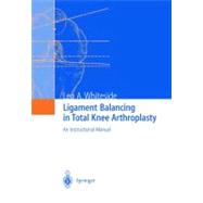 Ligament Balancing in Total Knee Arthroplasty: An Instructional Manual,9783540207498 Ligament Balancing in Total Knee Arthroplasty: An Instructional Manual,9783540207498