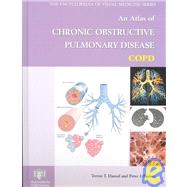 Atlas of Chronic Obstructive Pulmonary Disease, COPD