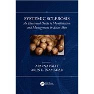 Systemic Sclerosis