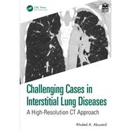 Challenging Cases in Interstitial Lung Diseases