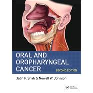 Oral Cancer: Causes, Prevention and Management of Malignancies of the Mouth and Oropharynx, Second Edition