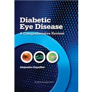 Diabetic Eye Disease A Comprehensive Review