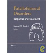 Patellofemoral Disorders Diagnosis and Treatment