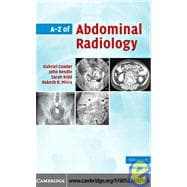 A-z of Abdominal Radiology