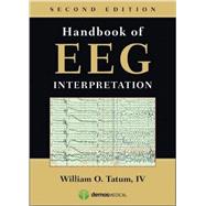Handbook of Eeg Interpretation