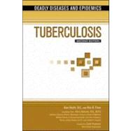 Tuberculosis