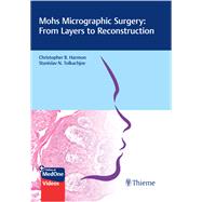 Mohs Micrographic Surgery: From Layers to Reconstruction