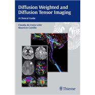 Diffusion Weighted and Diffusion Tensor Imaging