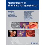 Microsurgery of Skull Base Paragangliomas