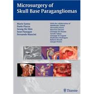Microsurgery of Skull Base Paragangliomas