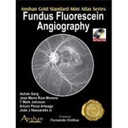 Fundus Fluorescein Angiography (Book with Mini CD-ROM)