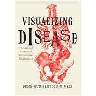 Visualizing Disease