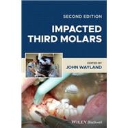Impacted Third Molars book cover, ISBN 9781119930303