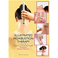 Illustrated Moxibustion Therapy A Natural Way of Prevention and Treatment through Traditional Chinese Medicine