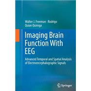 Imaging Brain Function With Eeg