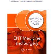 ENT Medicine and Surgery: Illustrated Clinical Cases