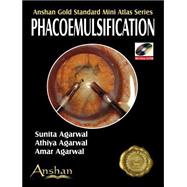Phacoemulsification (Book with DVD-ROM)