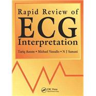 Rapid Review of ECG Interpretation