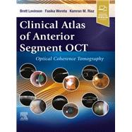Clinical Atlas of Anterior Segment OCT: Optical Coherence Tomography