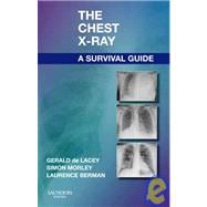 The Chest X-Ray: A Survival Guide,9780702030468