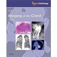 Imaging of the Chest