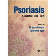 Psoriasis, Second Edition