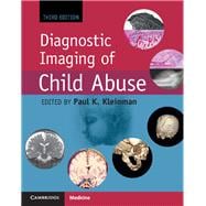 Diagnostic Imaging of Child Abuse