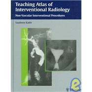 Teaching Atlas of Interventional Radiology
