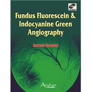 Fundus Fluorescien & Indocyanine Green Angiography (Book with CD-ROM)