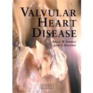 Valvular Heart Disease
