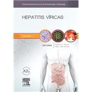 Hepatitis víricas