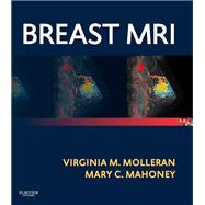 Breast MRI