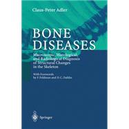 Bone Diseases,9783540650614