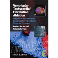 Ventricular Tachycardia / Fibrillation Ablation The state of the Art based on the VeniceChart International Consensus Document