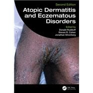Atopic Dermatitis and Eczematous Disorders