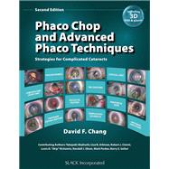 Phaco Chop and Advanced Phaco Techniques Strategies for Complicated Cataracts