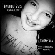 Beautiful Scars / Hermosas Cicatrices