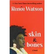 skin & bones a novel