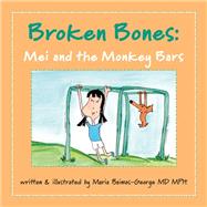 Broken Bones