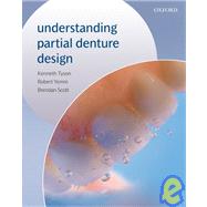 Understanding Partial Denture Design