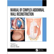 Manual of Complex Abdominal Wall Reconstruction