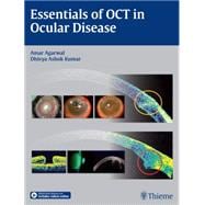 Essentials of Oct in Ocular Disease