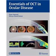 Essentials of OCT in Ocular Disease