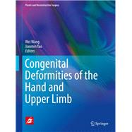 Congenital Deformities of the Hand and Upper Limb